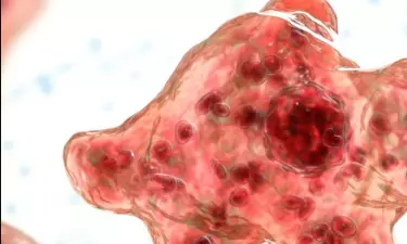 അമീബിക് മസ്തിഷ്ക ജ്വരം ബാധിച്ച് വീണ്ടും മരണം